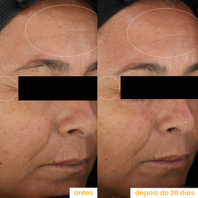 Super Vitamina C 20%